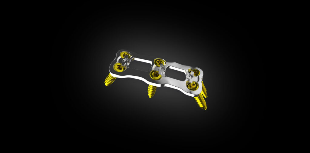 Cervical Plate System